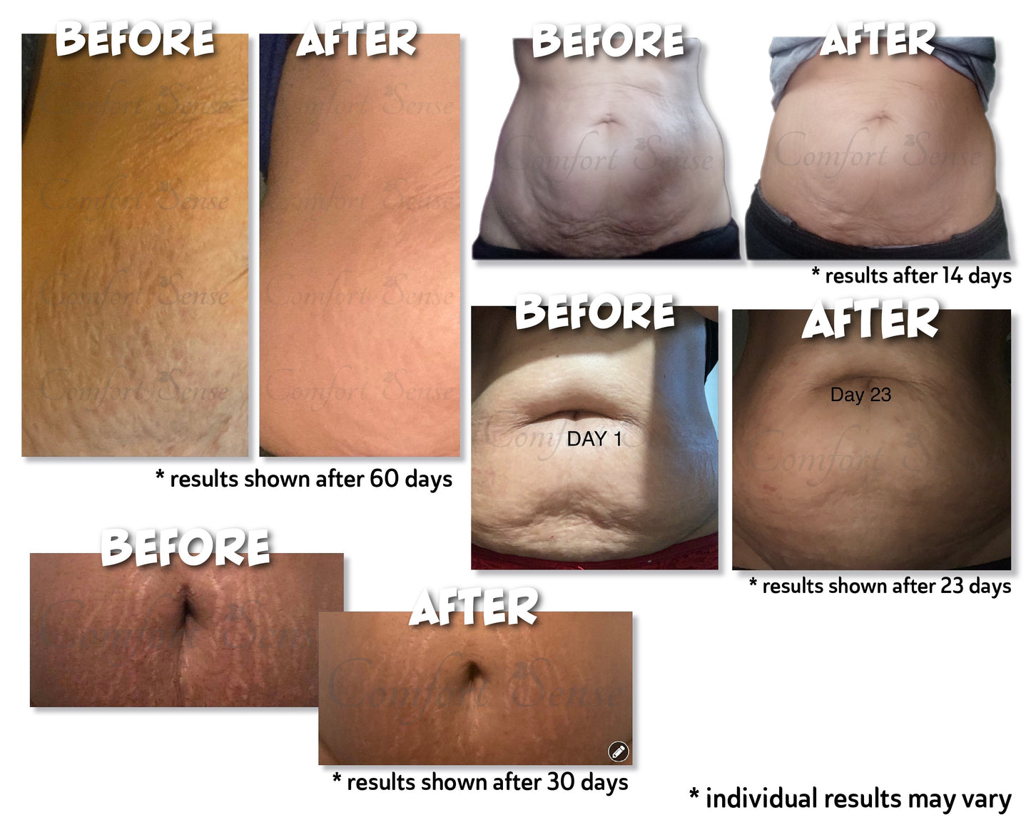 Cellulite & Skin Tightening “Tummy Tuck” Cream & Oil Combo