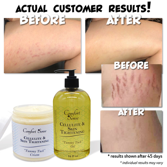Before and after results of a cellulite and skin tightening product with visible cream and oil bottles.