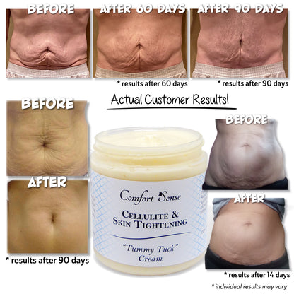 Cellulite & Skin Tightening “Tummy Tuck” Cream