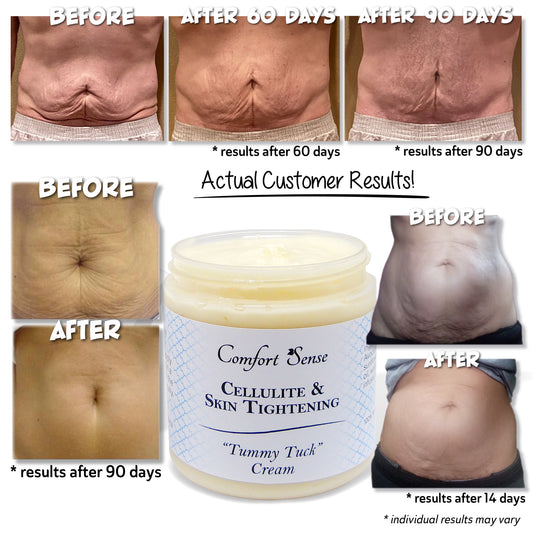 Cellulite & Skin Tightening “Tummy Tuck” Cream