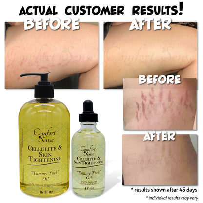 Cellulite & Skin Tightening “Tummy Tuck” Oil