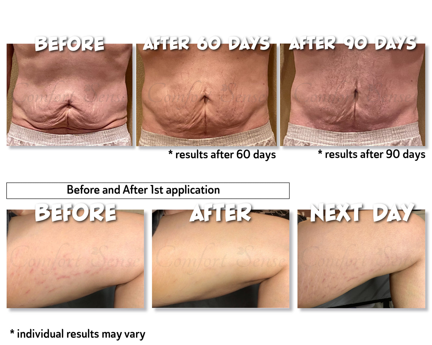 Cellulite & Skin Tightening “Tummy Tuck” Cream