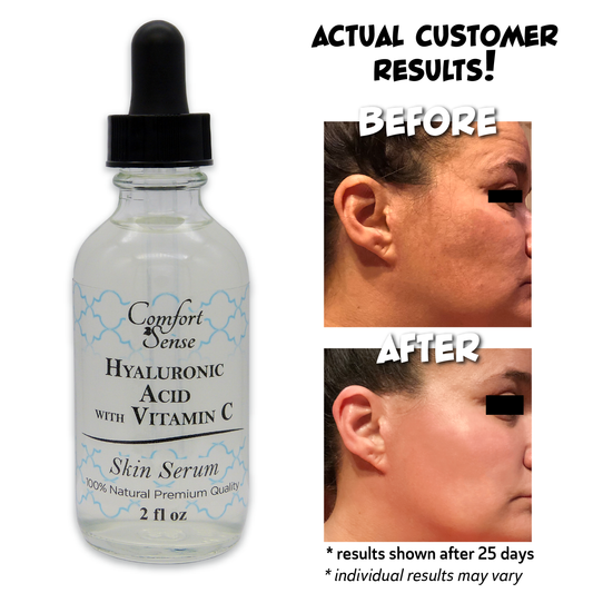 Hyaluronic Acid with Vitamin C & E