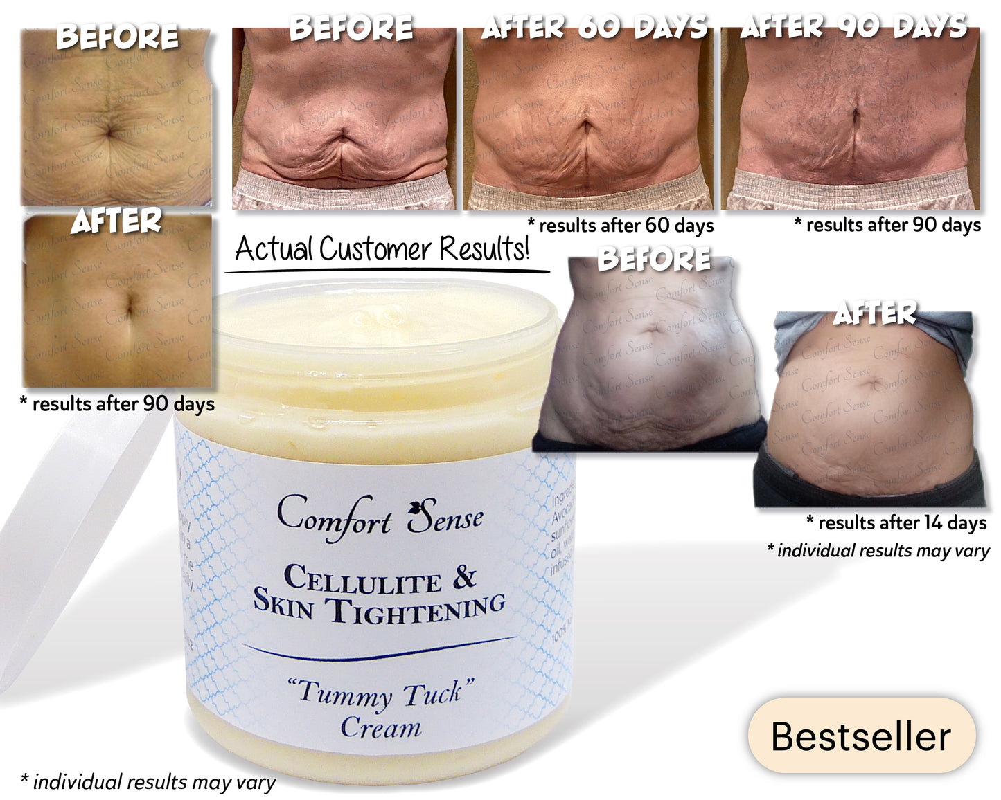 Cellulite & Skin Tightening Cream, Stretch Marks, Tummy Tuck